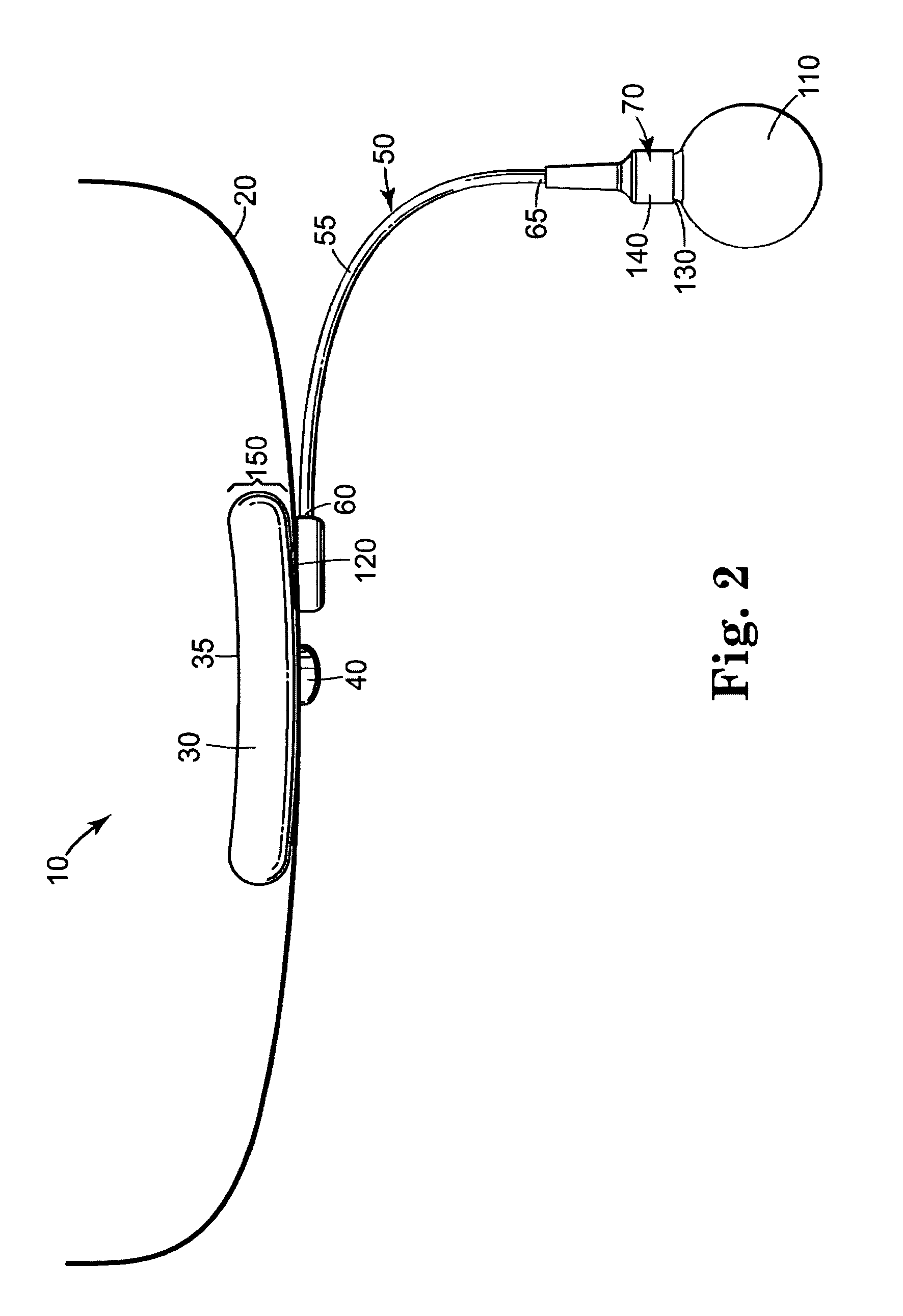 Male urethral prosthesis