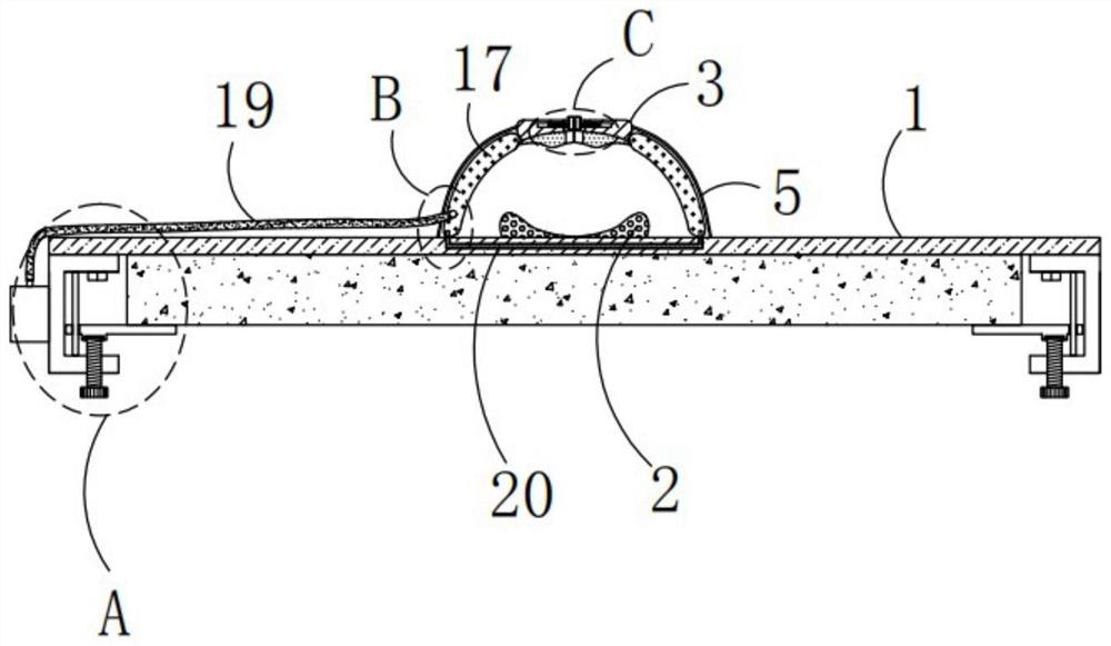 Trachea cannula positioning device for intensive care units