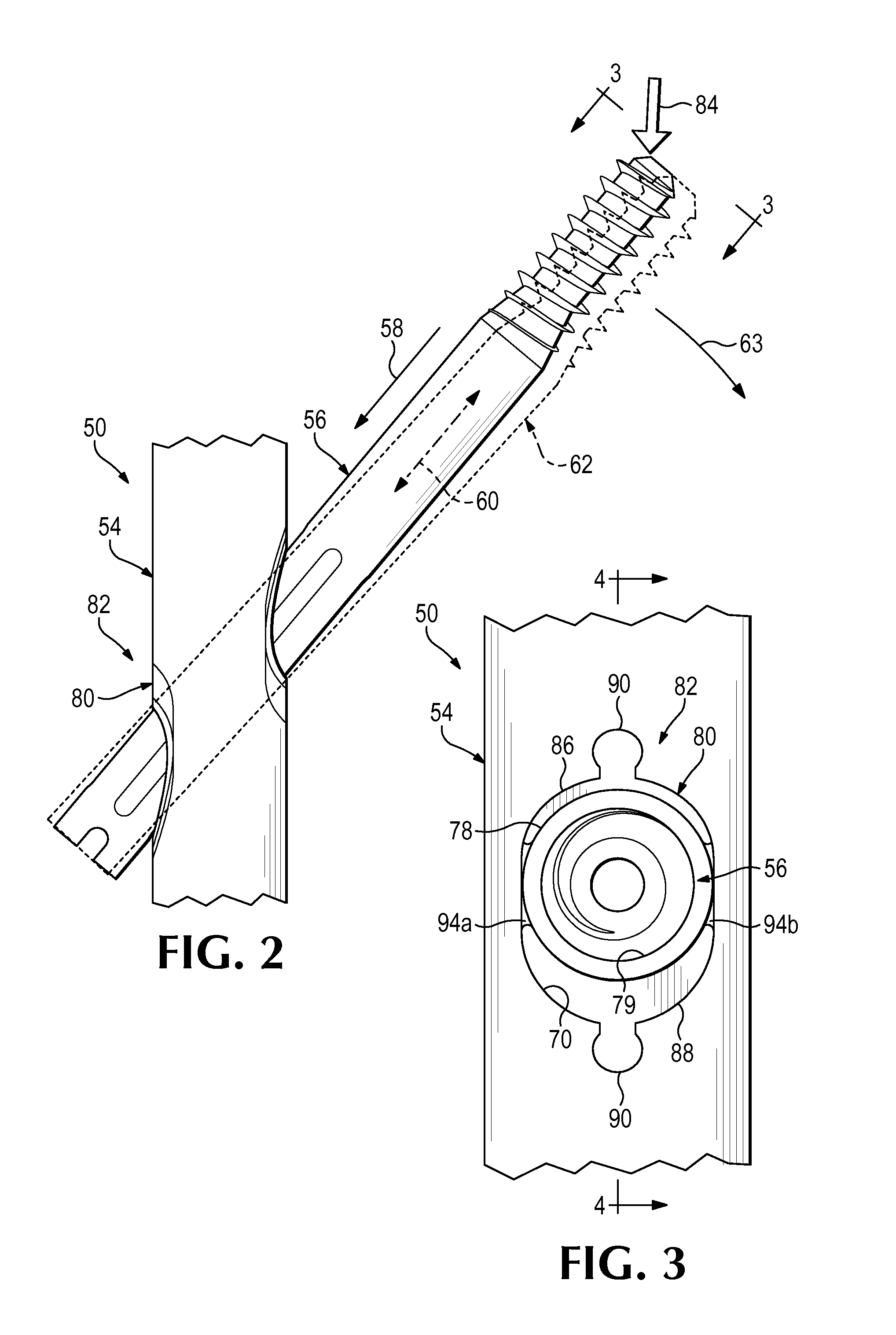 Nail-based compliant hip fixation system