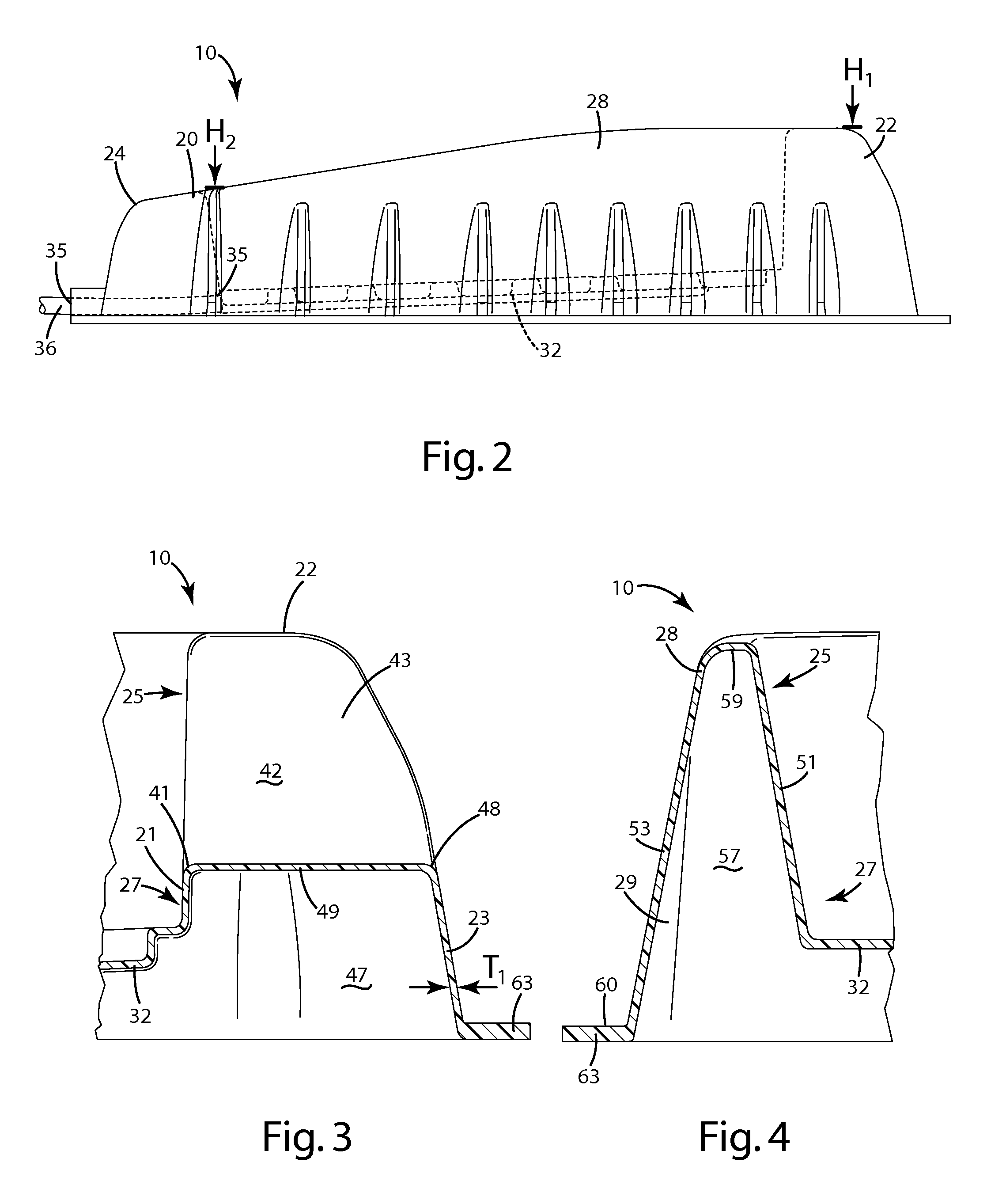 Irrigation, debridement and cleaning basin