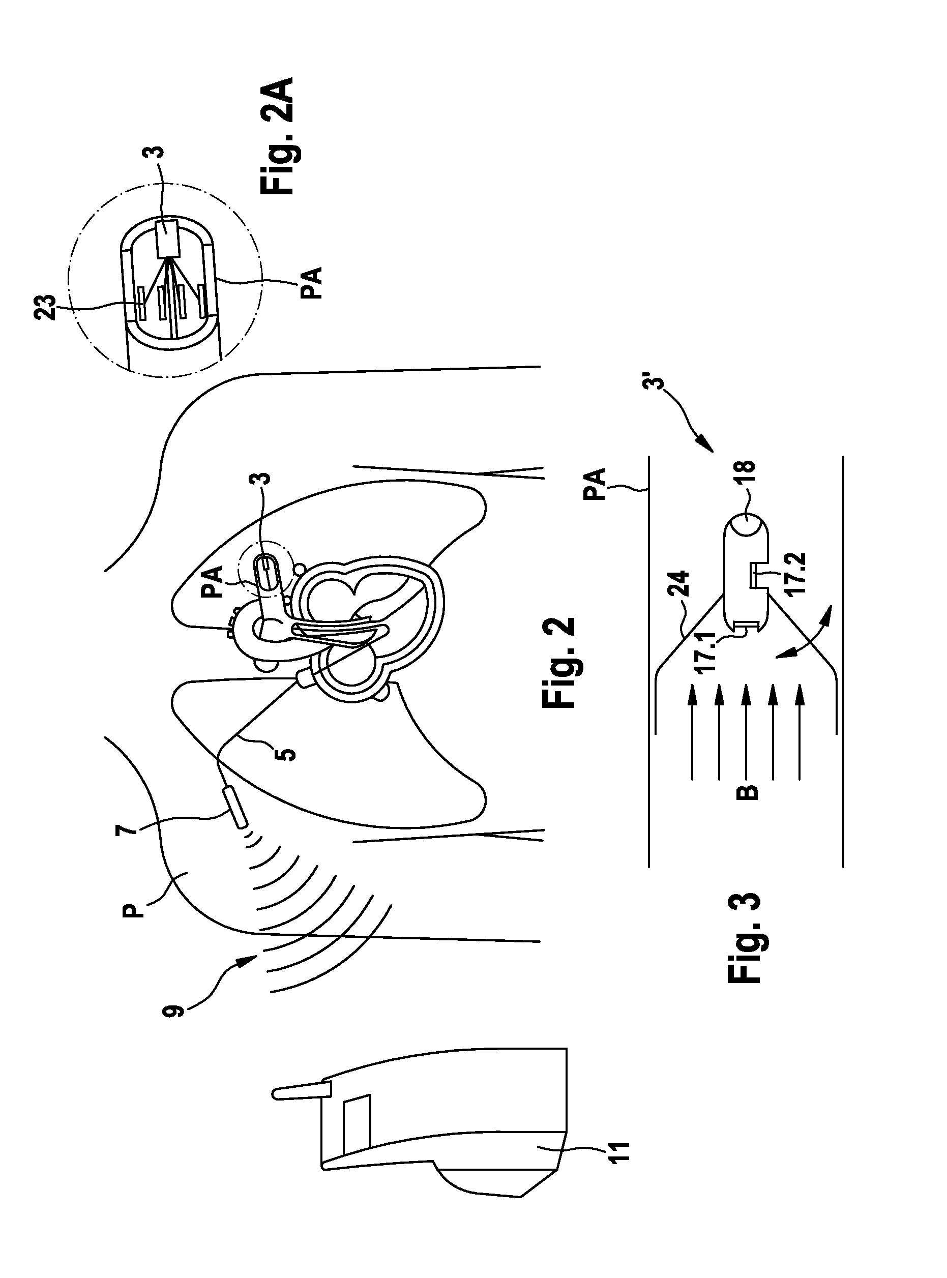 Implantable pressure measuring unit and configuration for internal pressure measurement in a blood vessel