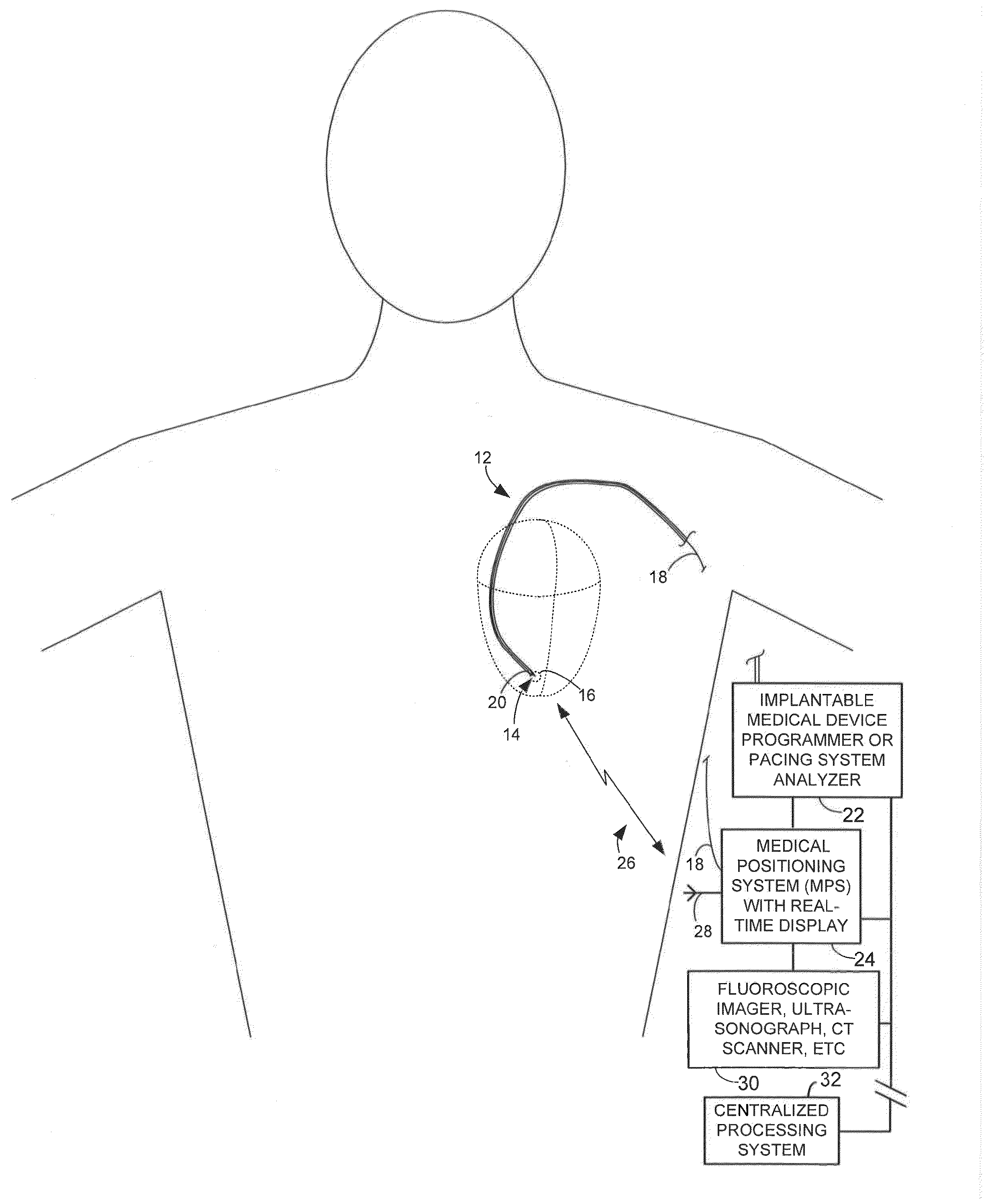 System and method for integrating candidate implant location test results with real-time tissue images for use with implantable device leads