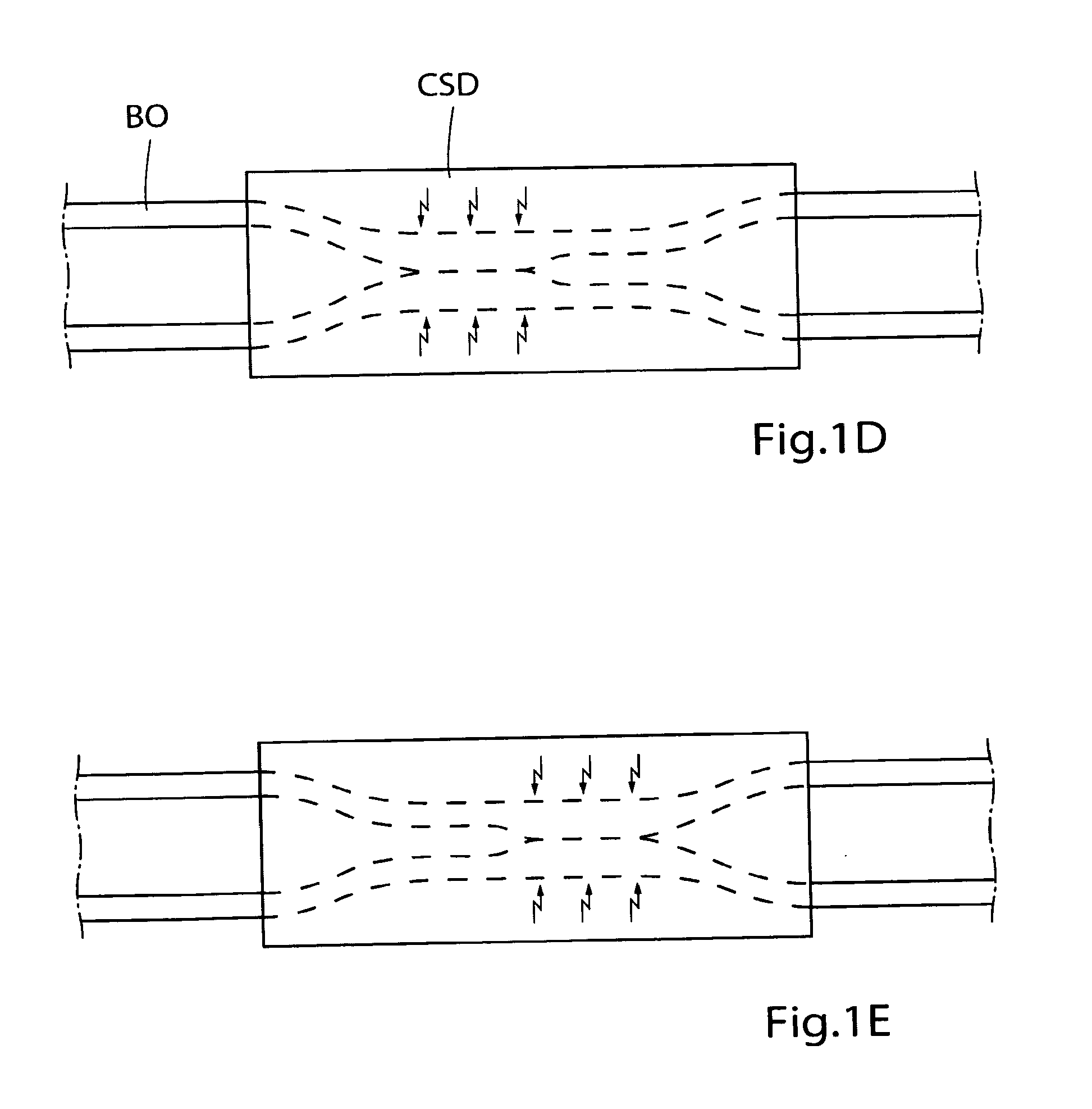 Method for controlling flow of intestinal contents in a patient's intestines