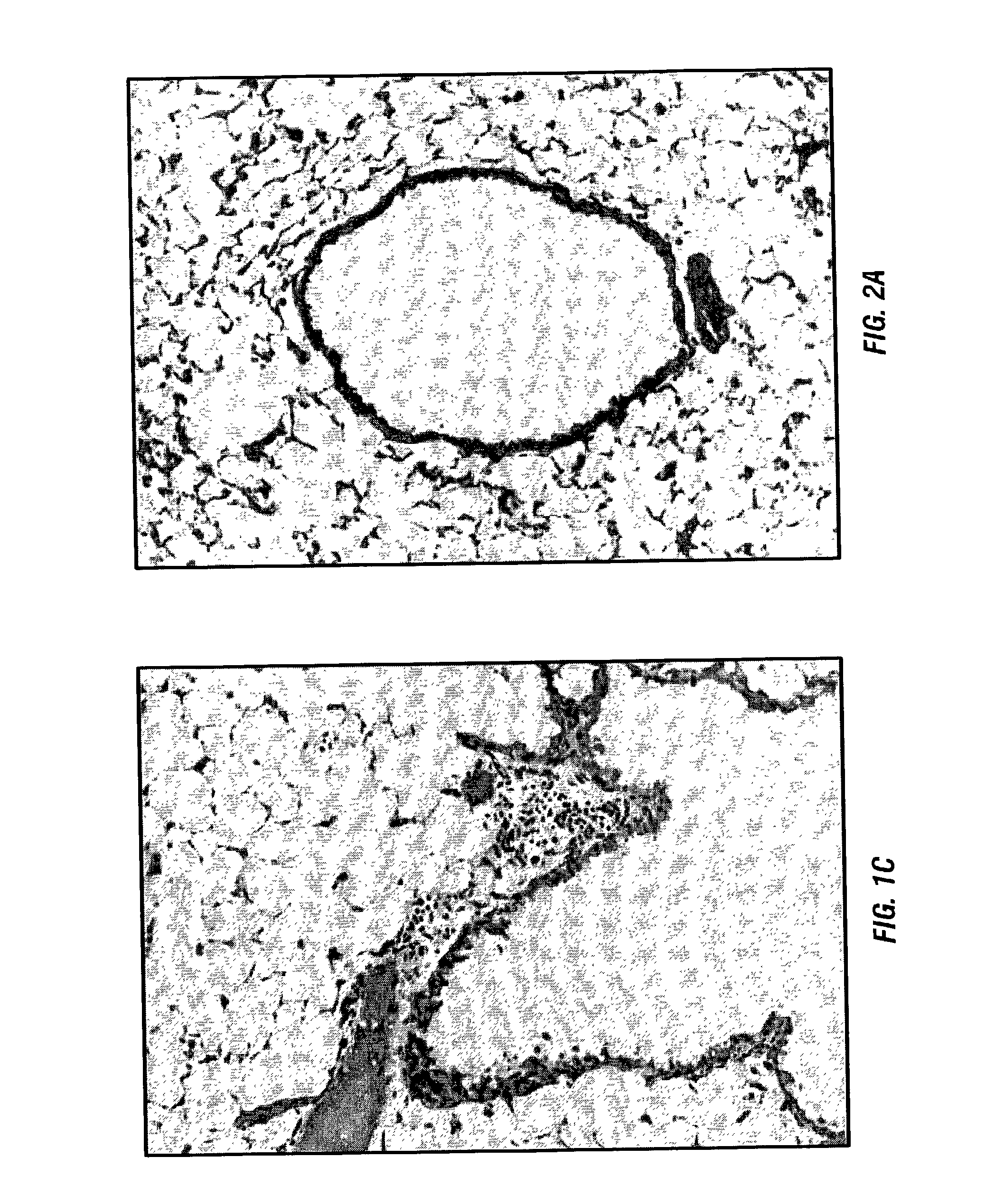 Oral tolerance induction by collagen to prevent allograft rejection