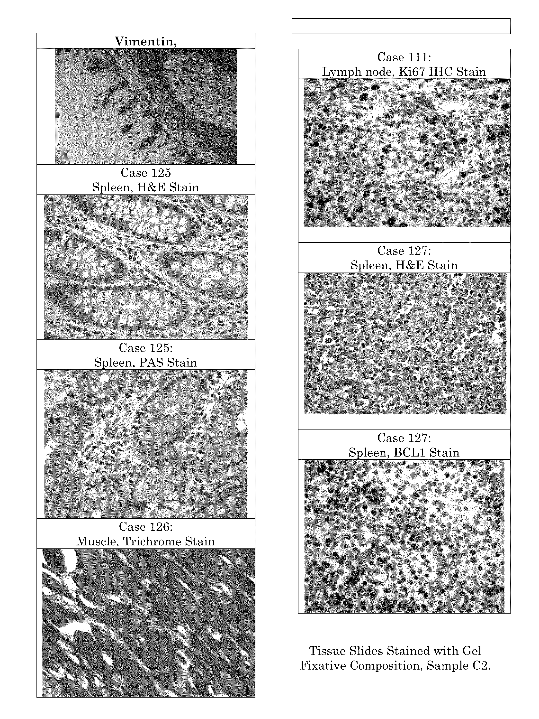 Tissue Fixative Having Increased Viscosity