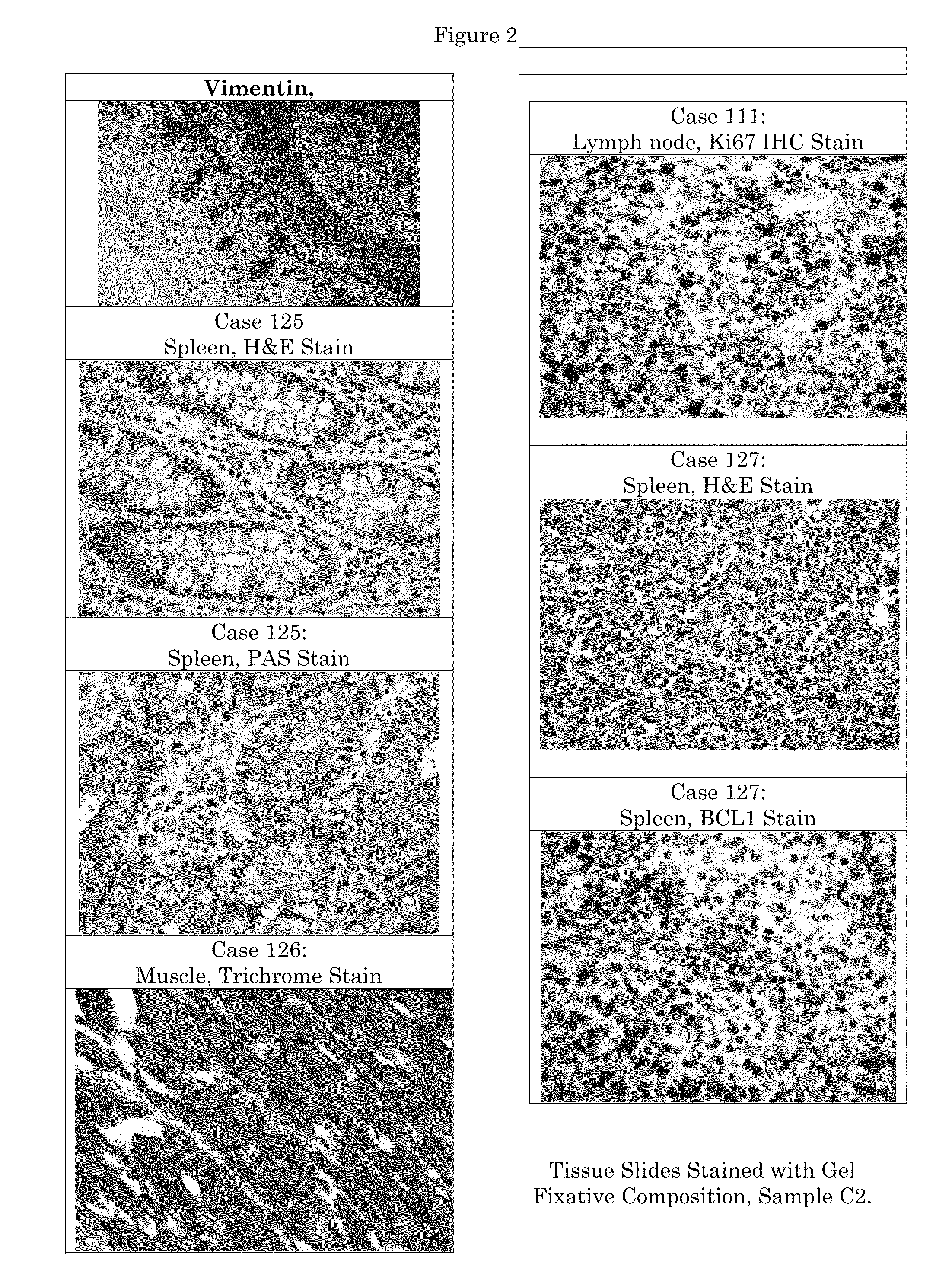 Tissue Fixative Having Increased Viscosity