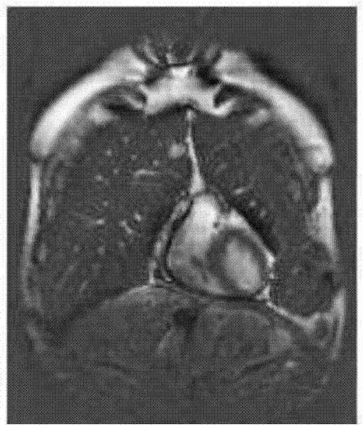 Heart magnetic resonance imaging (MRI) image deblurring method based on sparse low rank and dictionary learning