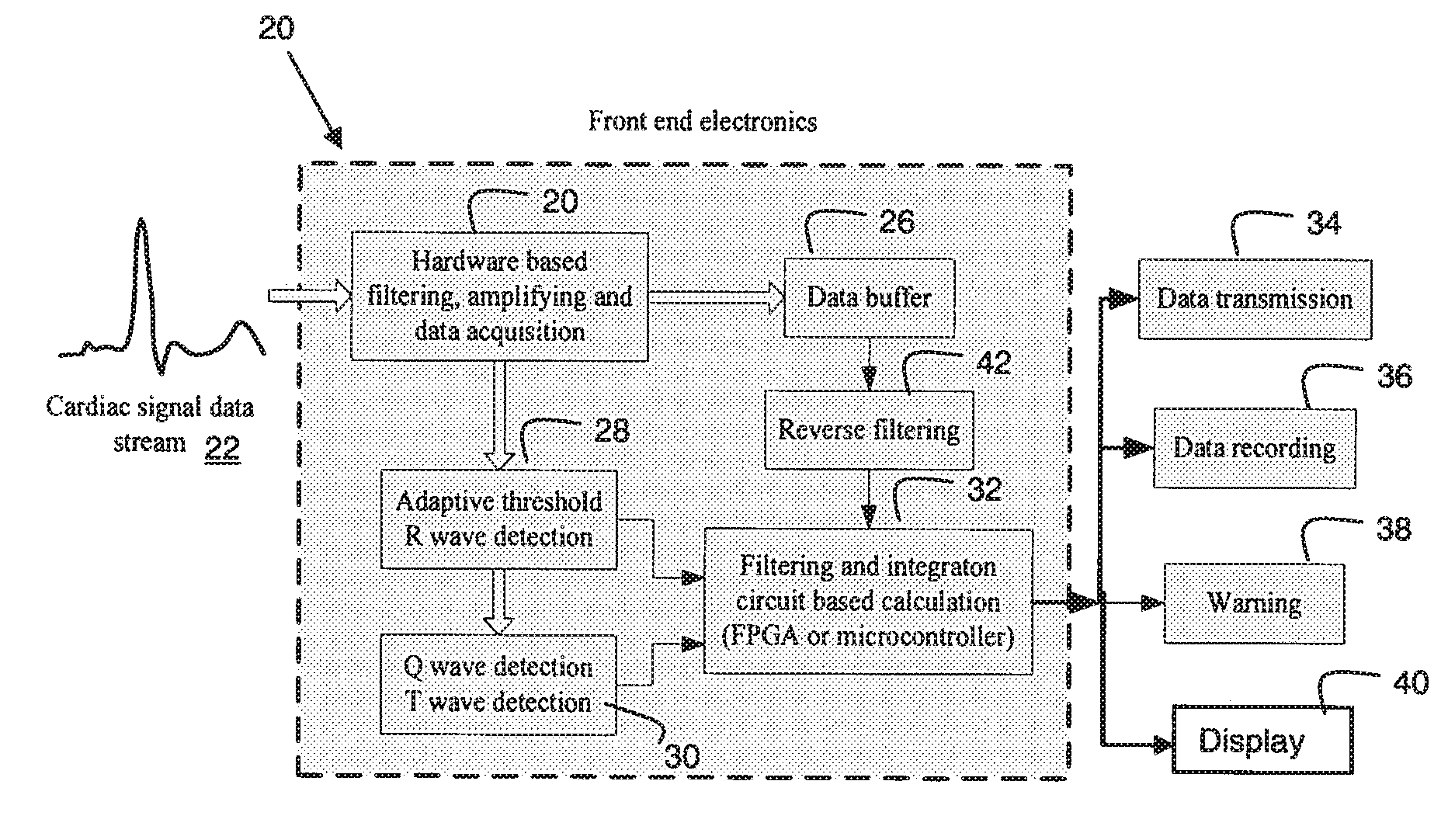 System for Cardiac Medical Condition Detection and Characterization