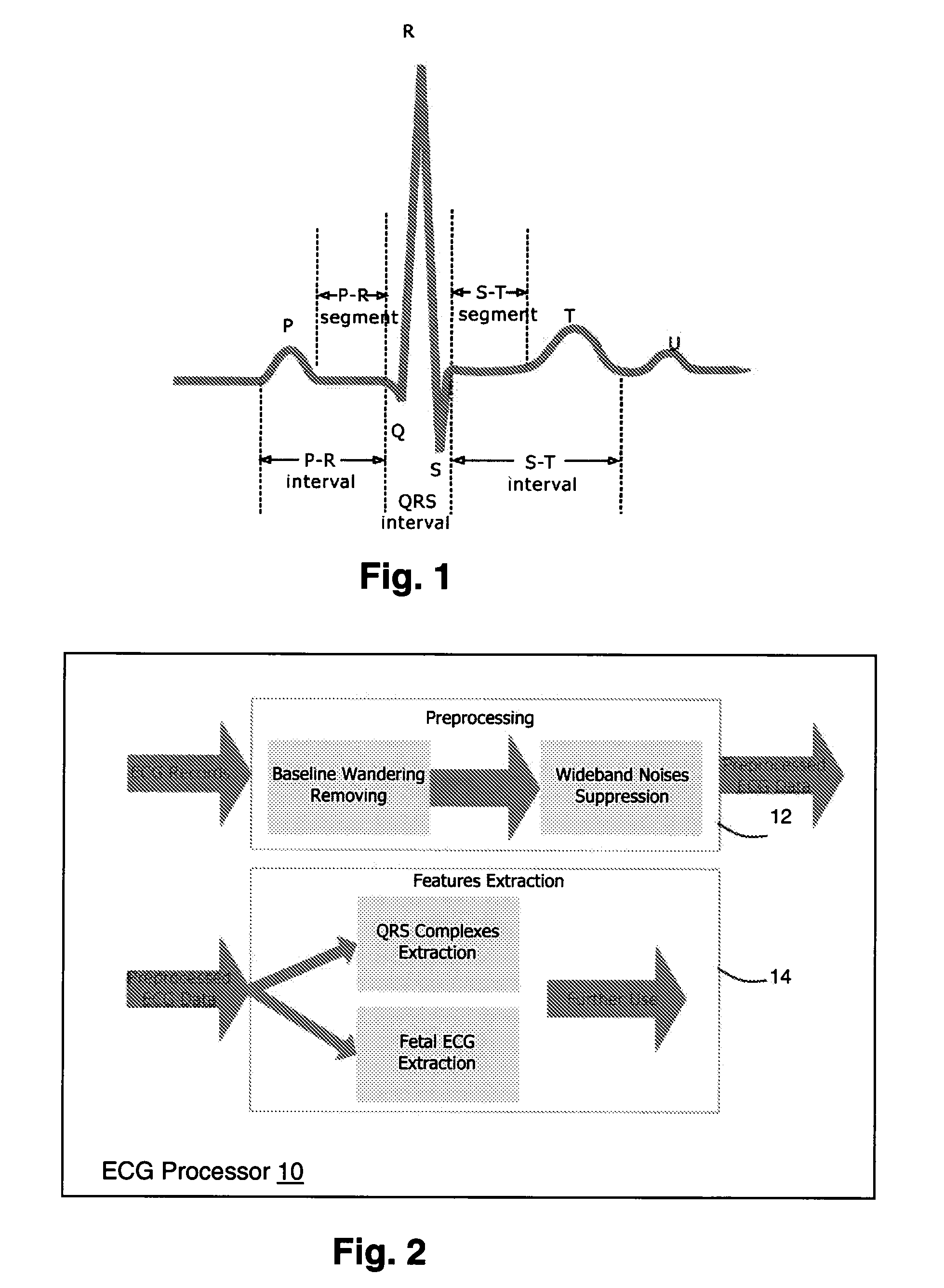 System for Cardiac Medical Condition Detection and Characterization