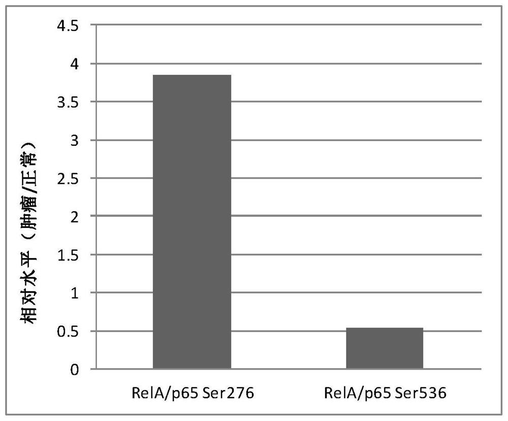 nf-κb RelA/p65 protein site-specific phosphorylation diagnostic kit