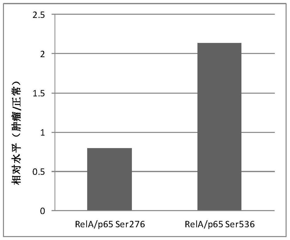 nf-κb RelA/p65 protein site-specific phosphorylation diagnostic kit