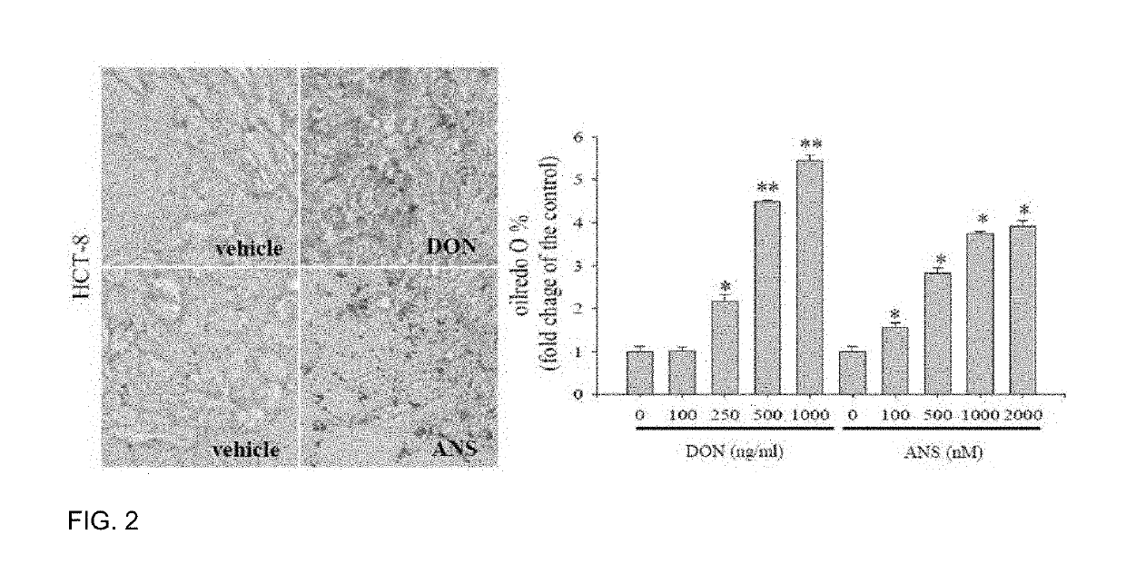 Pharmaceutical composition for preventing or treating ldl cholesterol-related diseases, containing ribosome-binding preparation