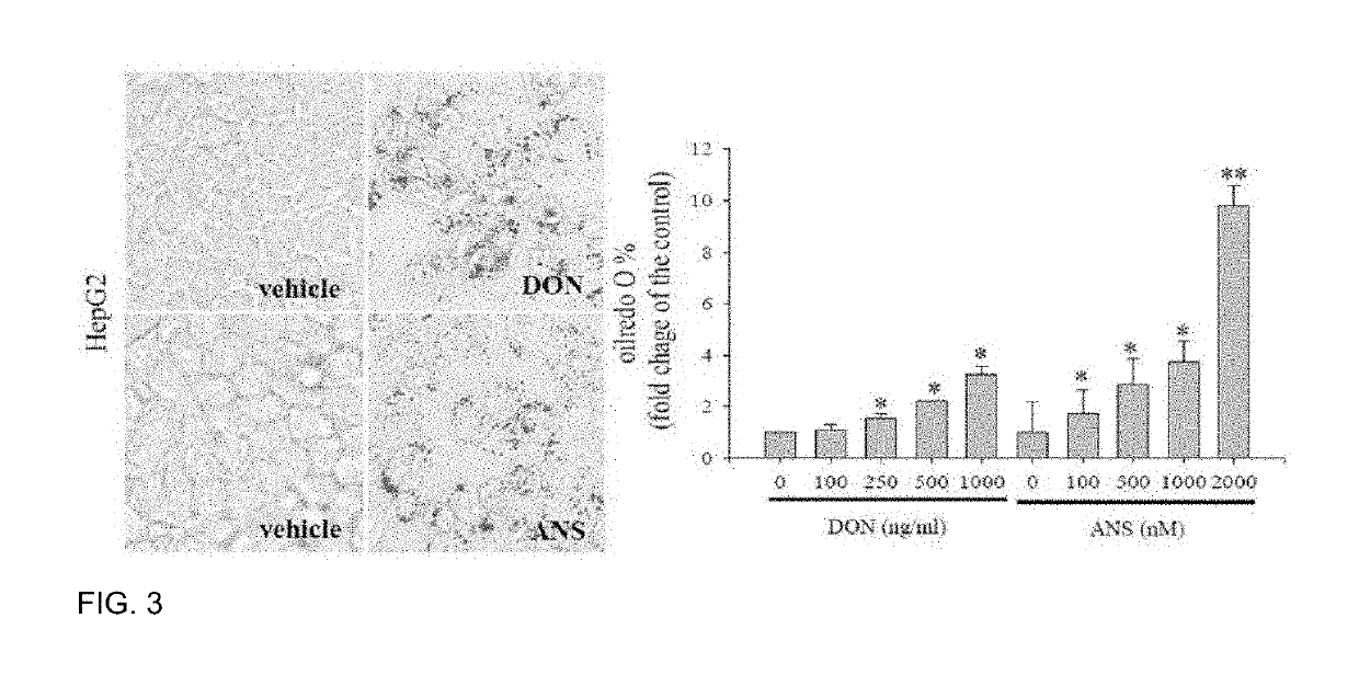 Pharmaceutical composition for preventing or treating ldl cholesterol-related diseases, containing ribosome-binding preparation