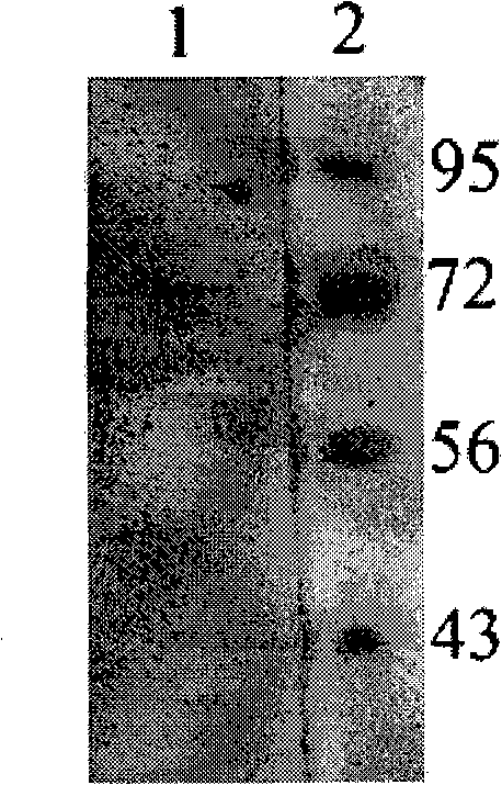 Anti-dengue virus E protein monoclone antibody, preparation method and uses thereof