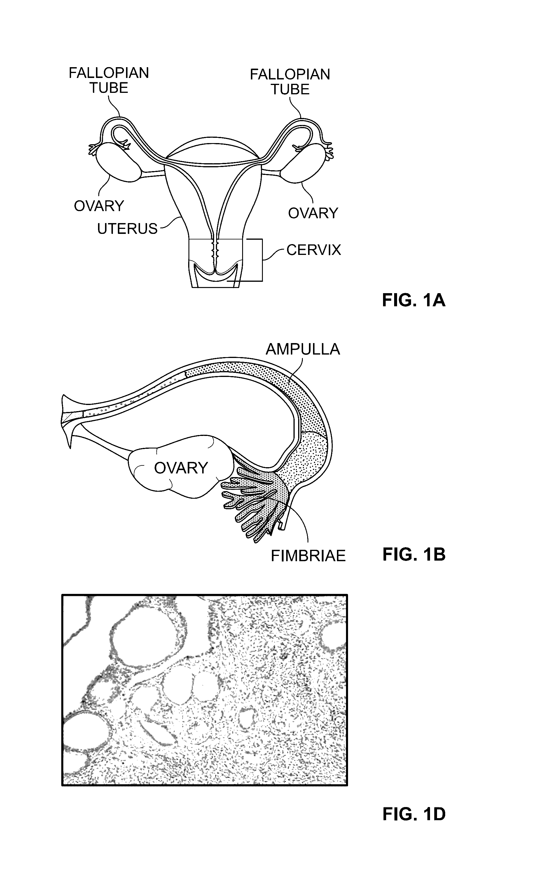 Compositions and methods for culturing cells from normal human tubo-ovarian epithelium and human tubo-ovarian tumors