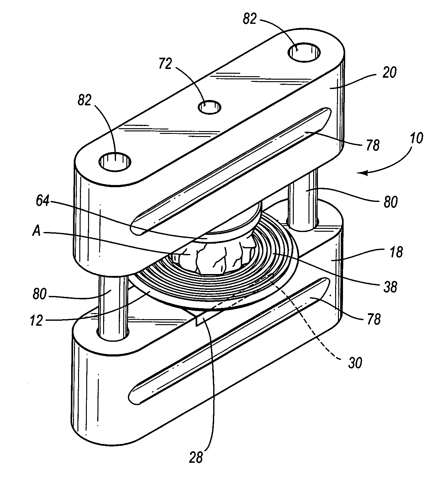 System for preparing cutaneous tissue samples for oncological histology study and diagnosis