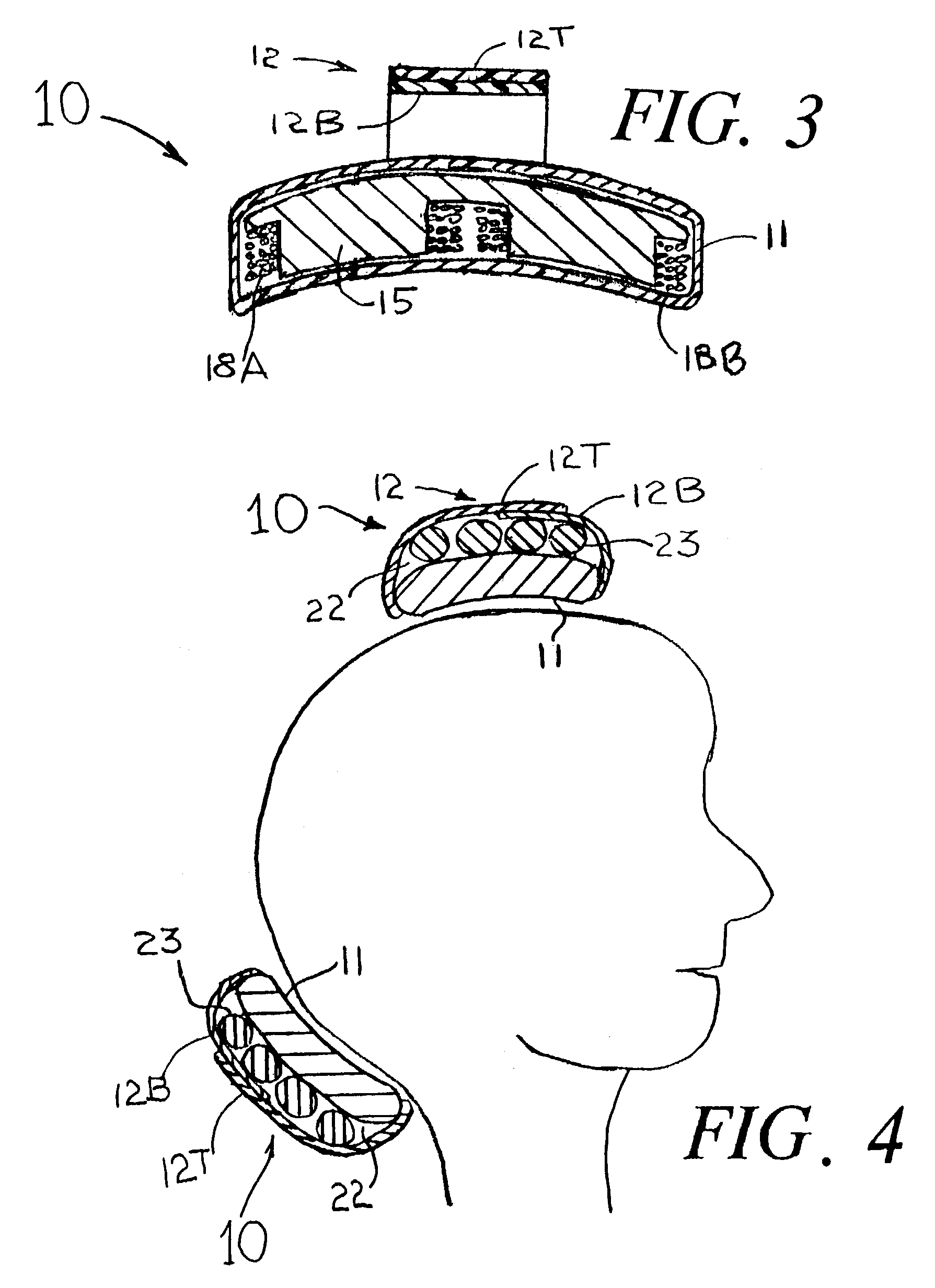 Means and methods for treating headaches