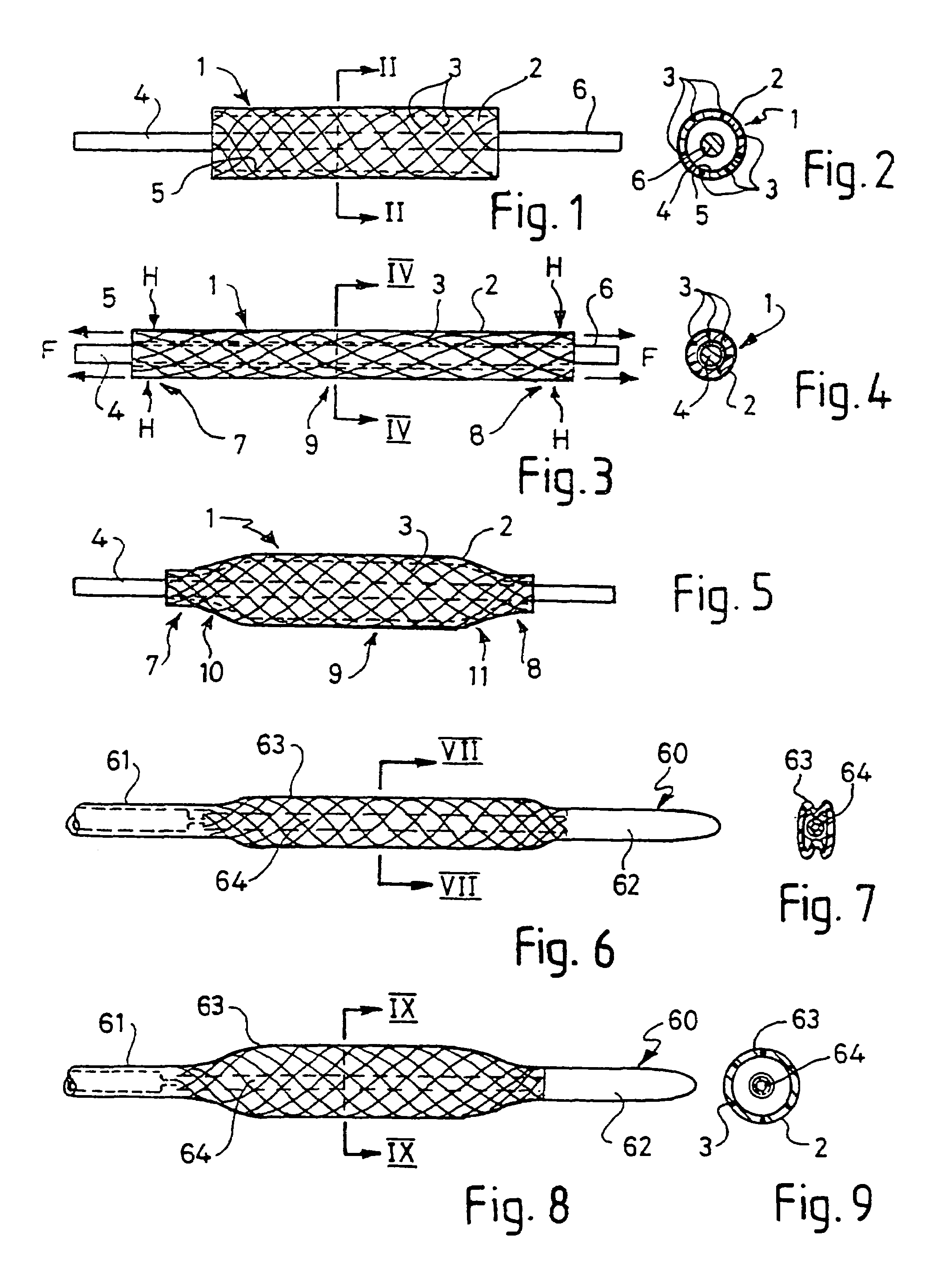 Balloon catheter