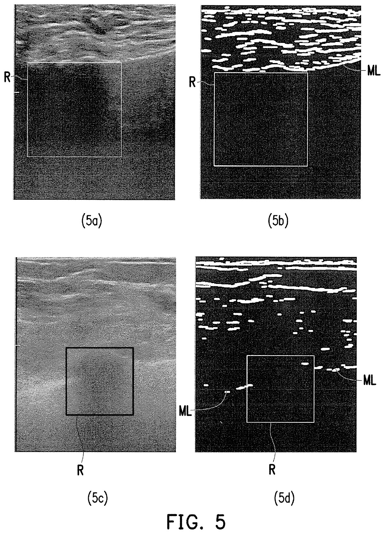 Analysis method for breast image and electronic apparatus using the same