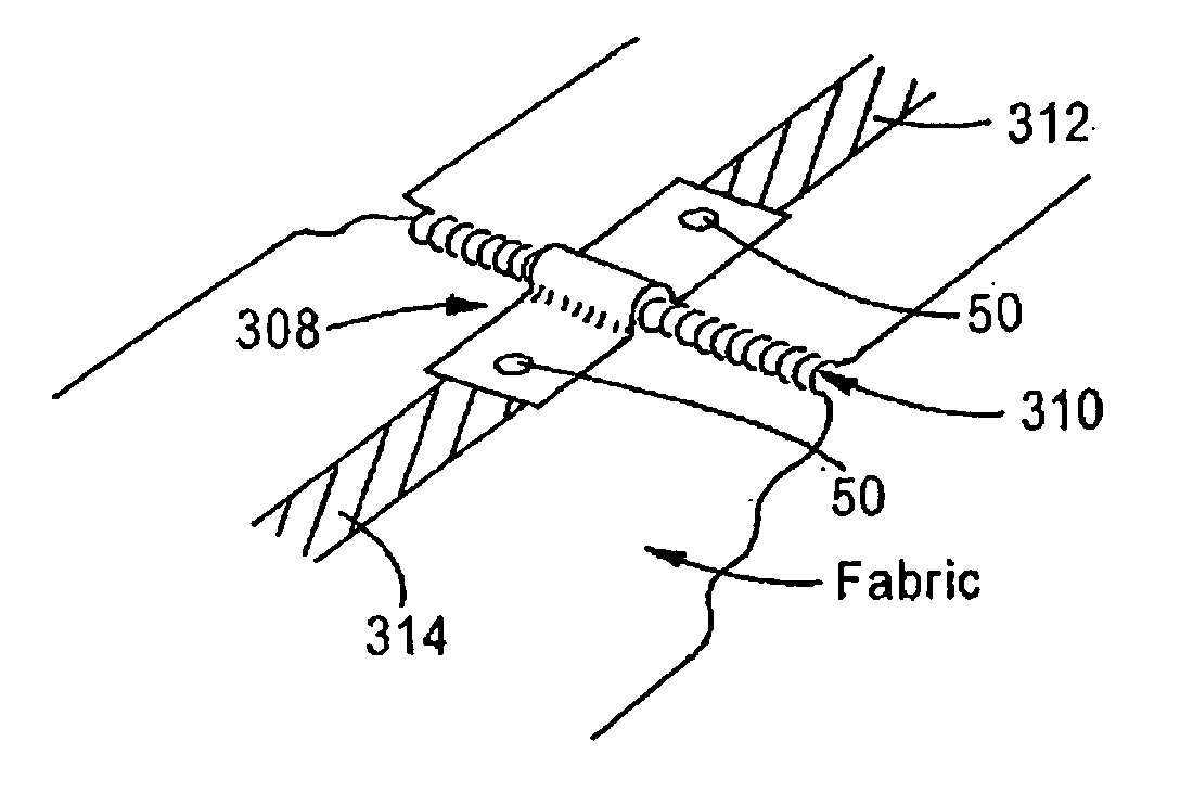 Electrically conductive fabric jumpers