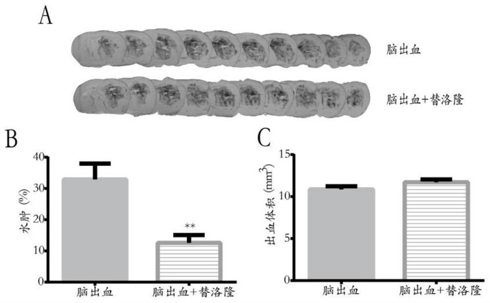 Use of Tivolone in the preparation of a medicament for reducing cerebral edema in hemorrhagic stroke