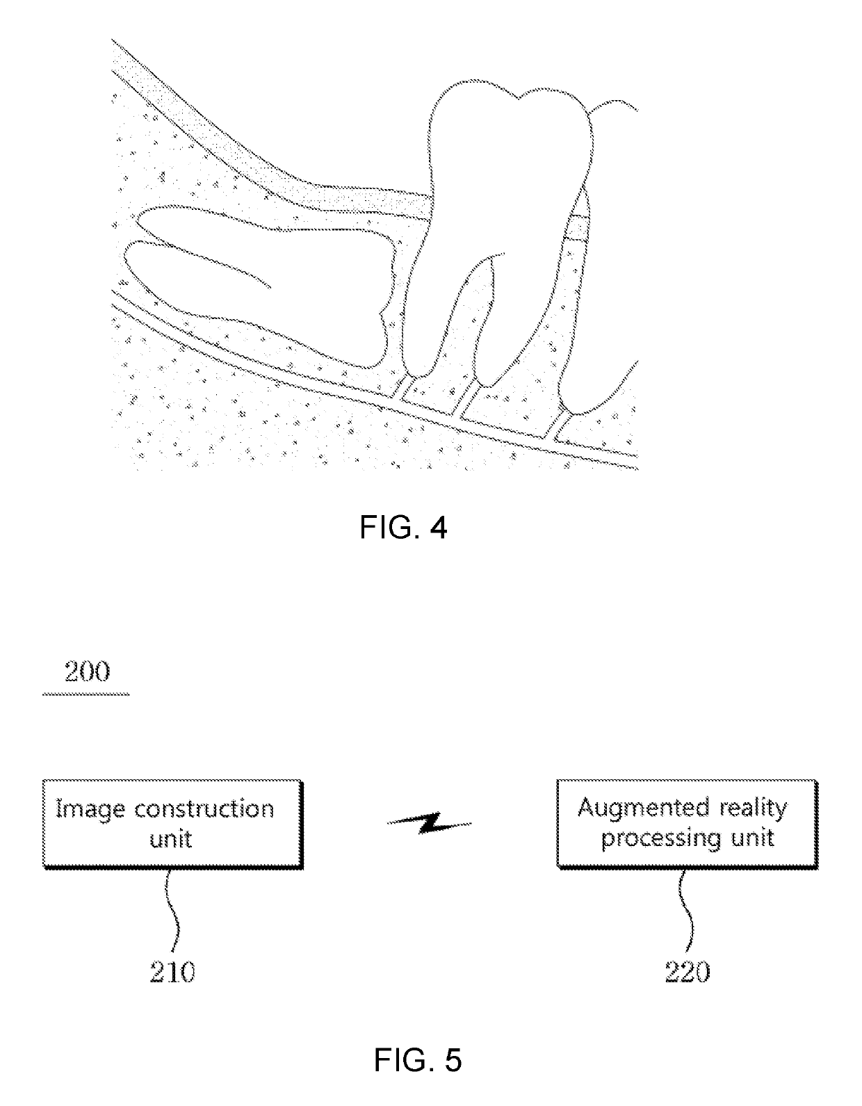 Augmented reality system and method for implementing augmented reality for dental surgery