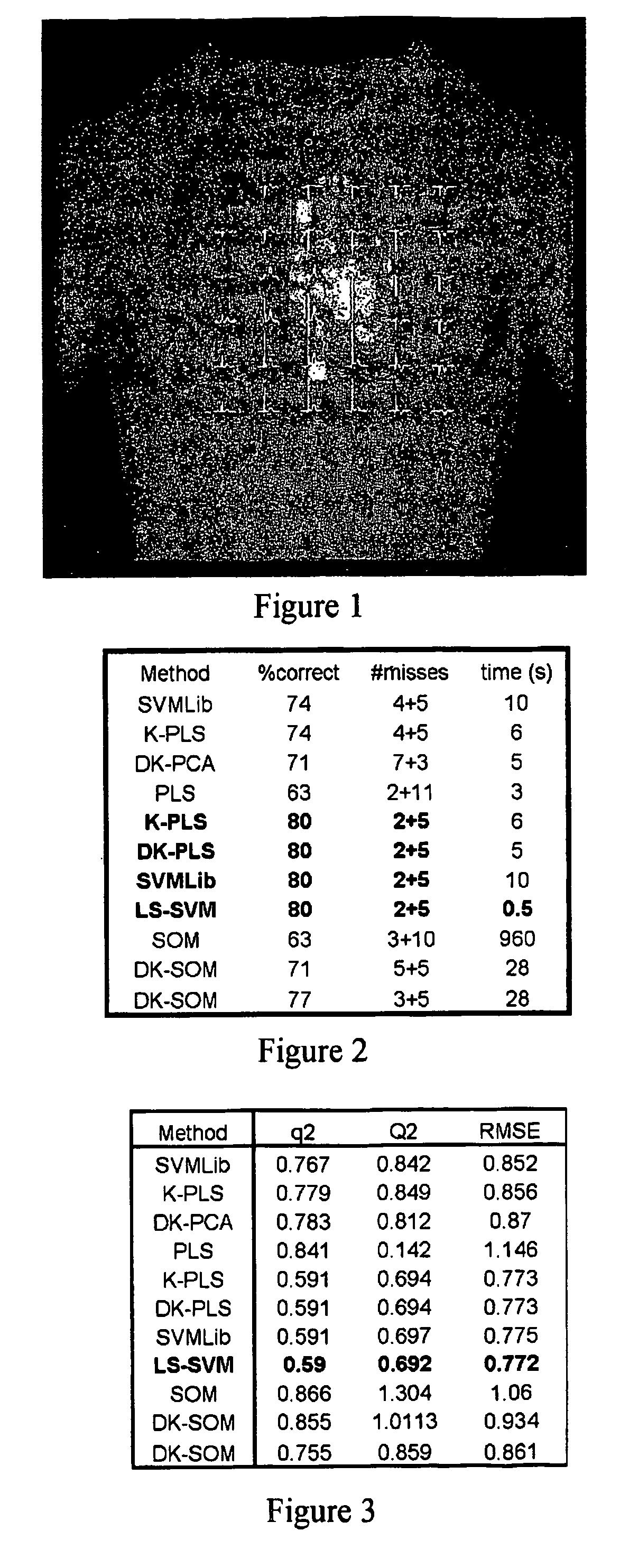 Use of machine learning for classification of magneto cardiograms