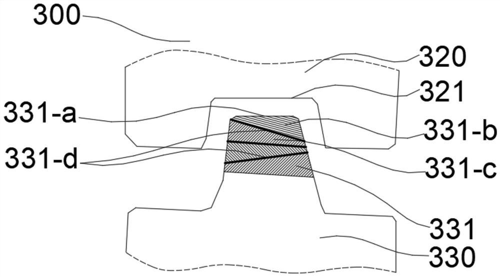 Bracket-free invisible orthodontic vertical control device used after orthognathic operation