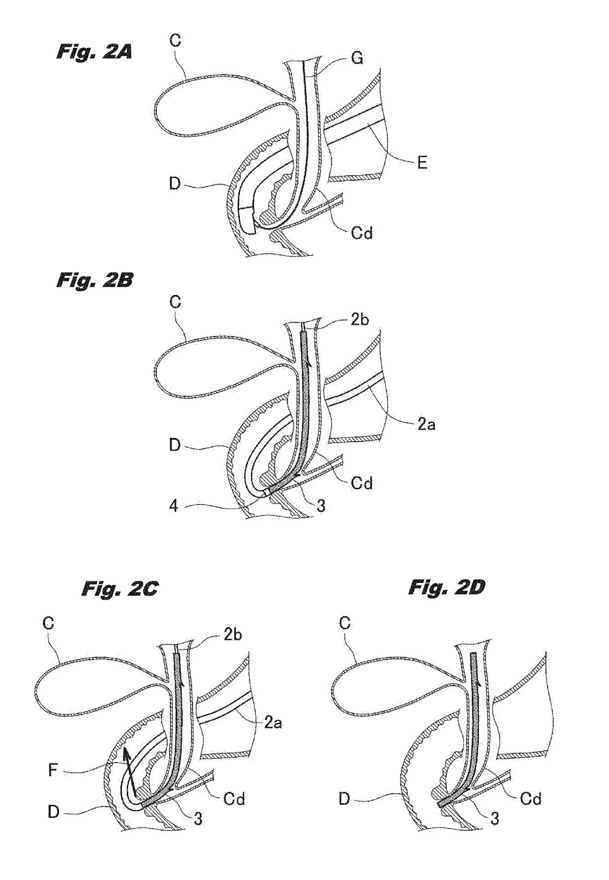 Biliary tract drainage tube