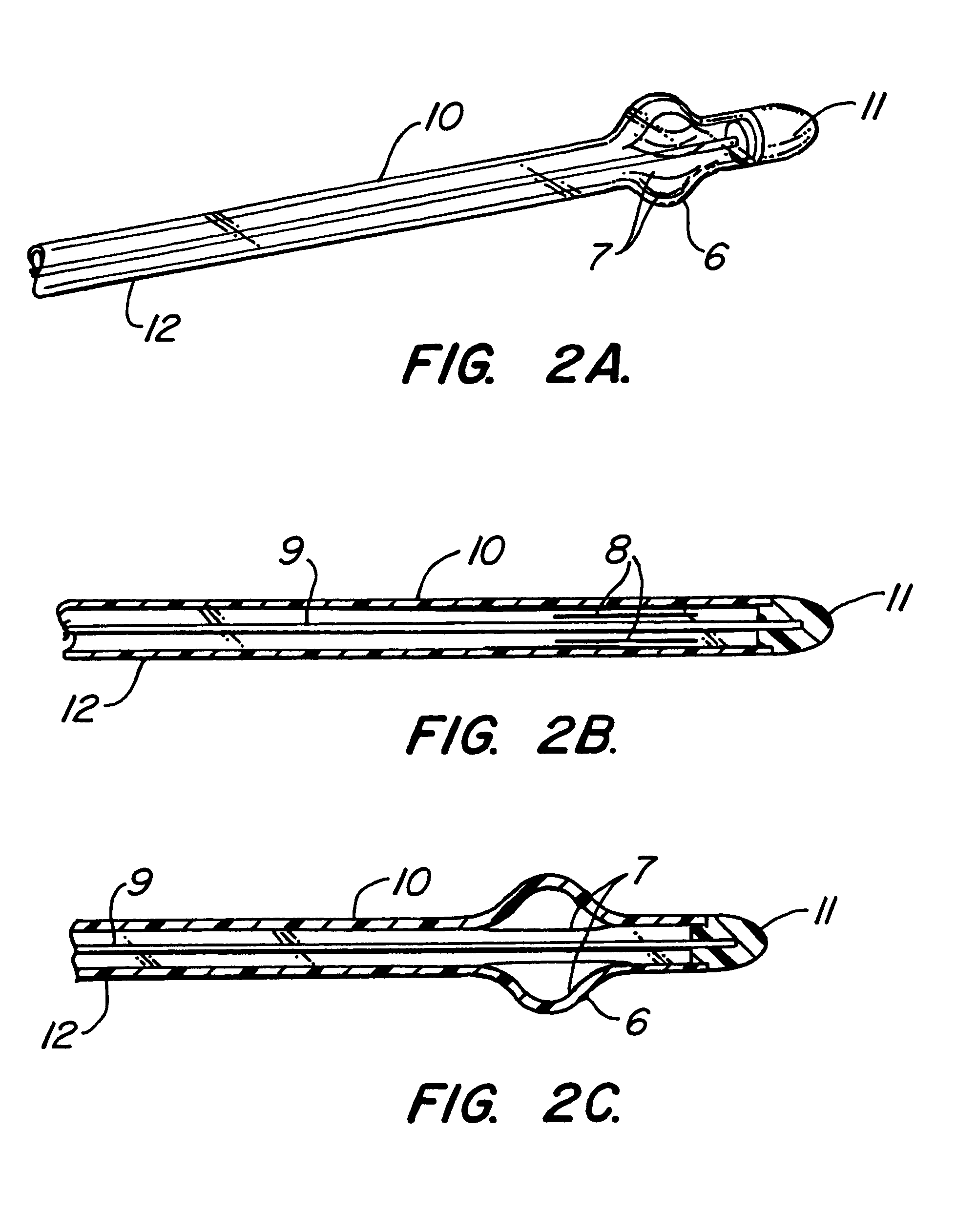 Tissue separation medical device and method