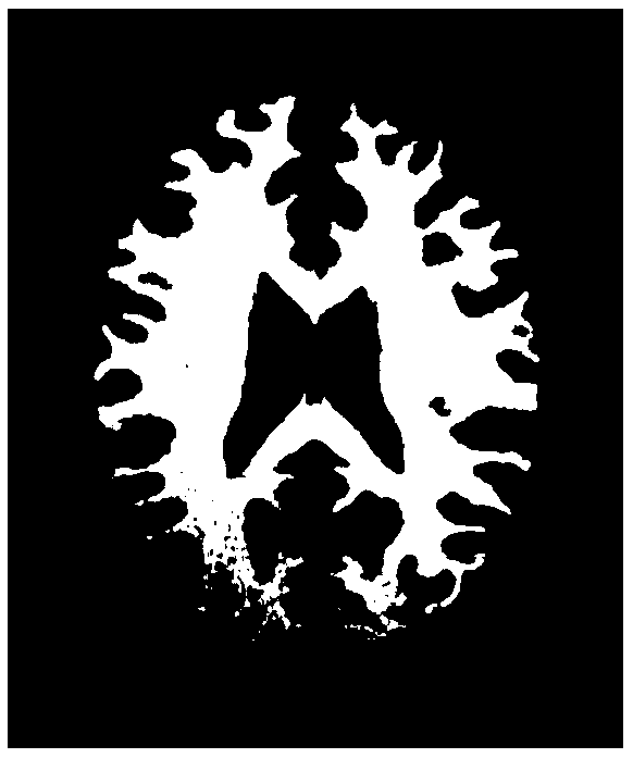 A brain MRI image segmentation method combined with biological characteristics