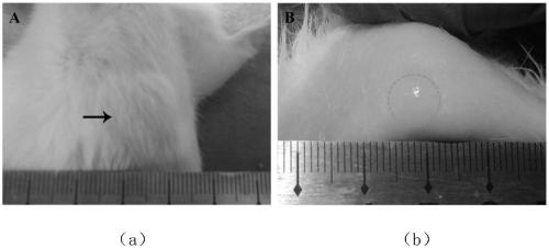 In-situ forming injectable hydrogel for bone-cartilage integrated restoration