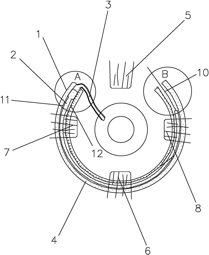 Adjustable glaucoma drainage tube