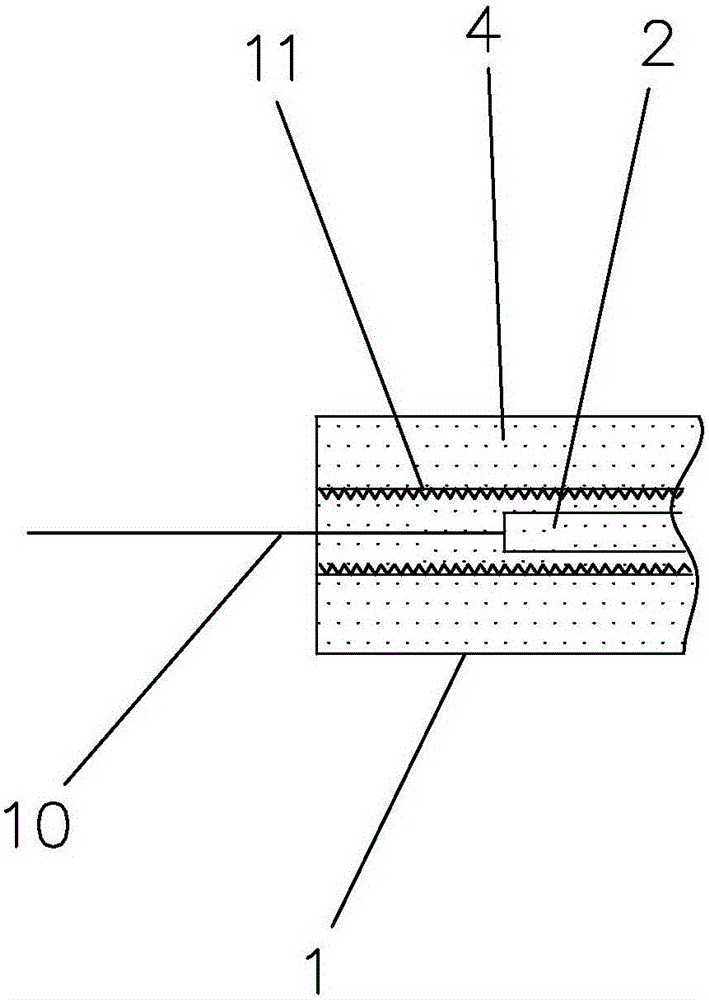 Adjustable glaucoma drainage tube