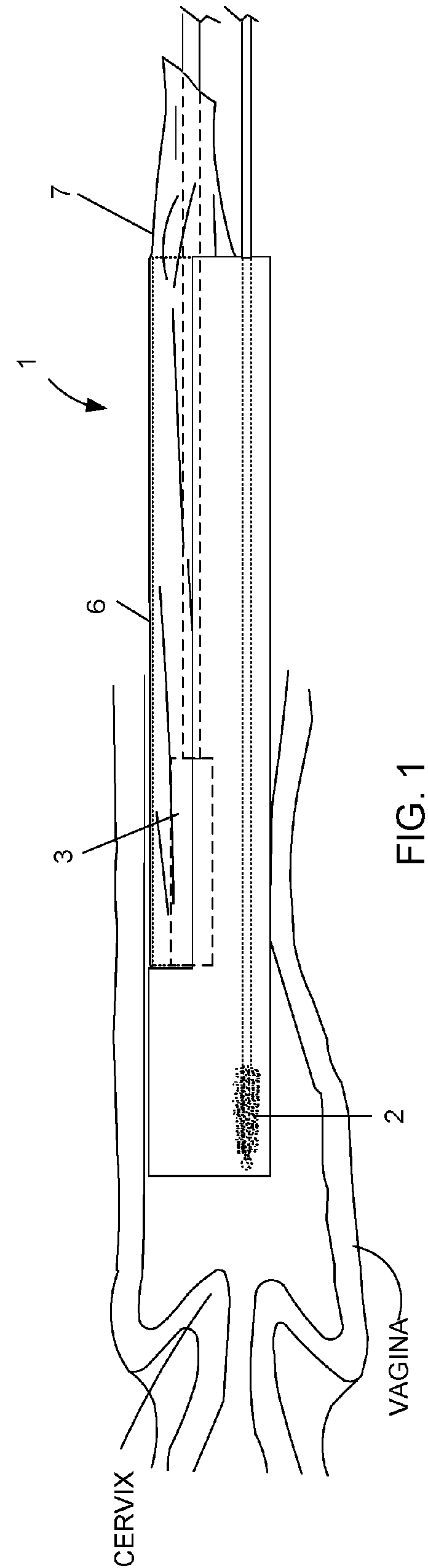 Device and method for conducting a pap smear test