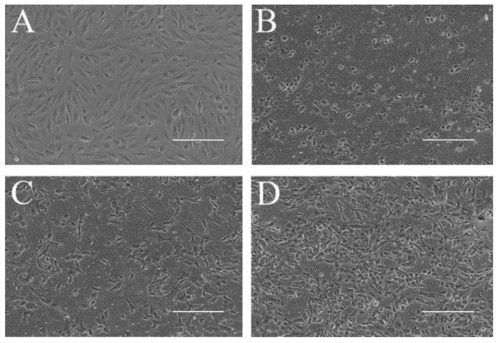 Preparation method of functionalized retinal pigment epithelial cell graft