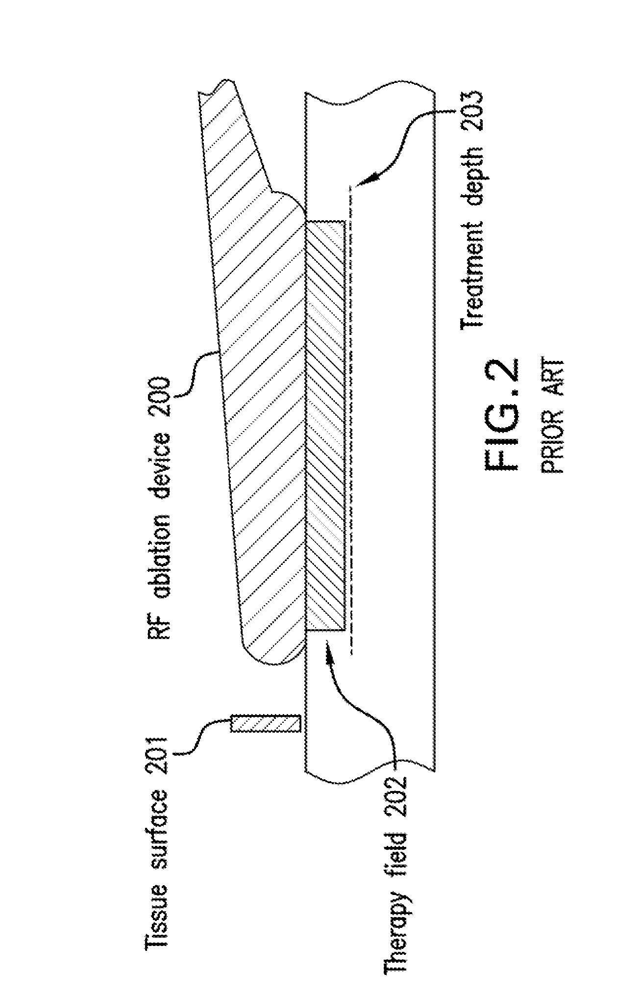 Systems, devices, apparatus and method devices for providing endoscopic mucosal therapy