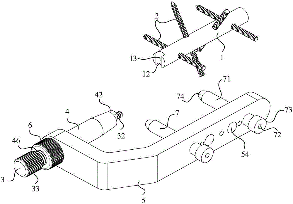 Calcaneal intramedullary fixation system and auxiliary placement instruments