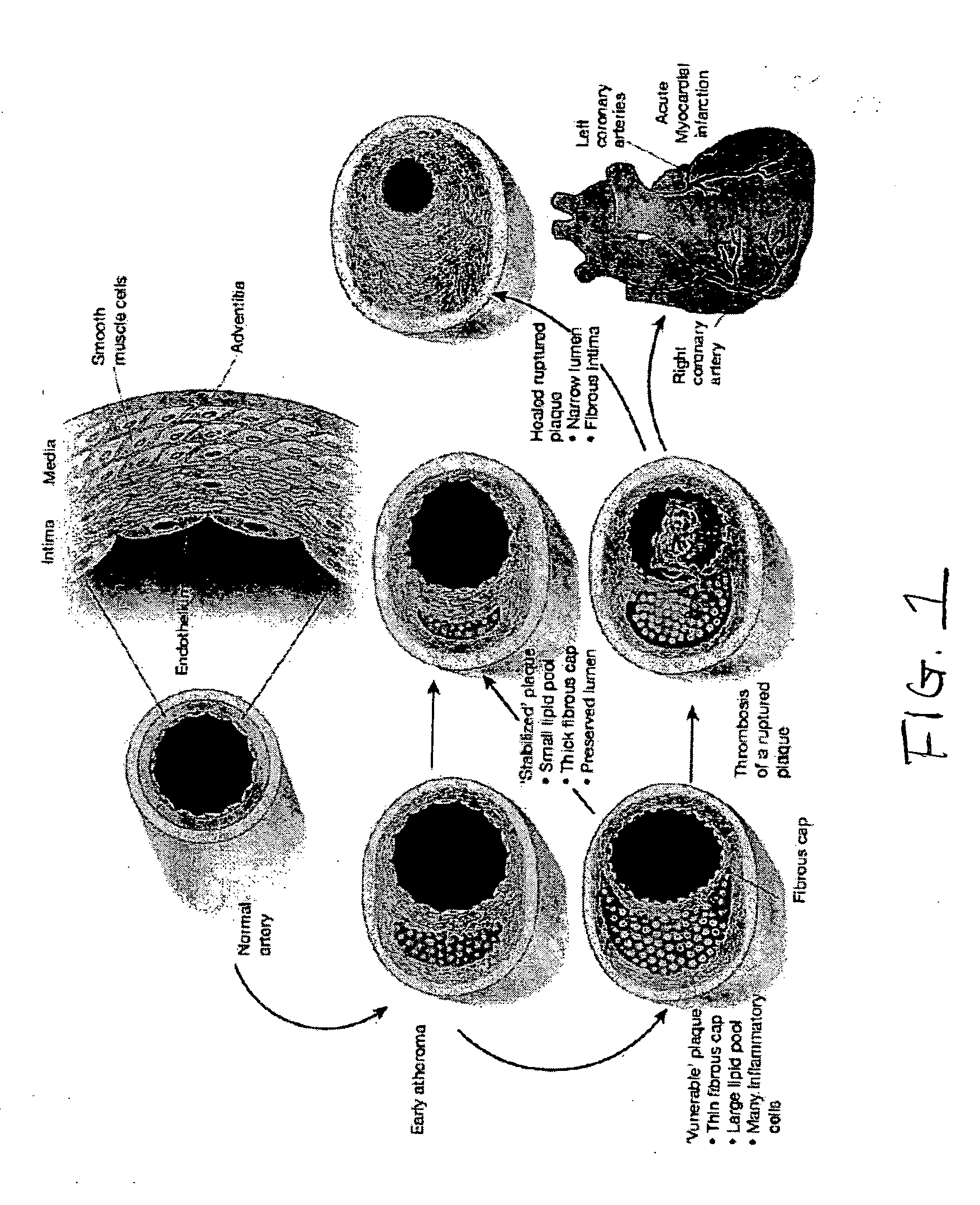 Non-invasive treatment of disease using amphipathic compounds