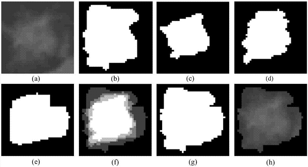 Improved deep Boltzmann machine-based pulmonary nodule feature extraction and benign and malignant classification method