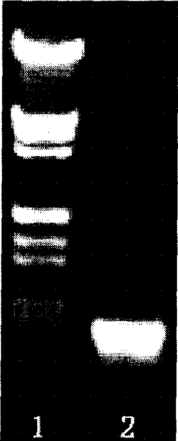 Preparation method of recombination staphylococcus aureus enterotoxin C2