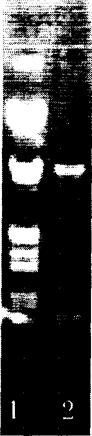 Preparation method of recombination staphylococcus aureus enterotoxin C2