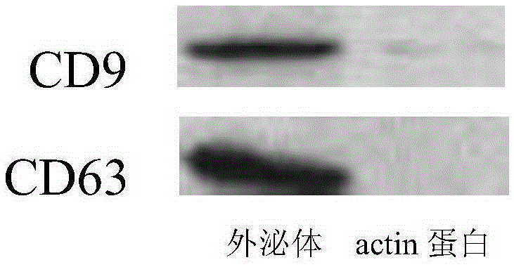 Method for promoting human bone mesenchymal stem cell proliferation based on exosome