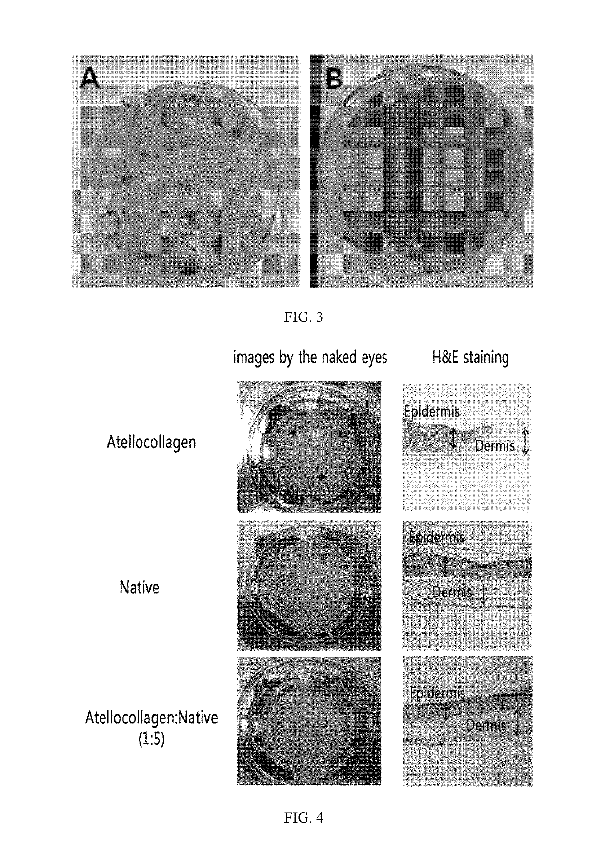 Method for preparing a three-dimensionally cultured skin comprising dermis and epidermis, and the cultured skin made therefrom