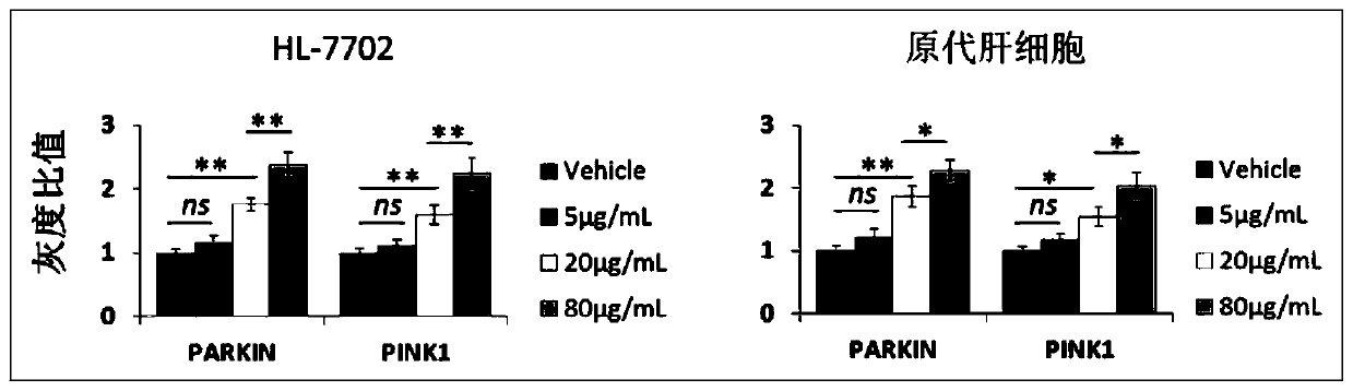 Application of mesenchymal stem cell exosome in preparation of preparations for promoting mitophagy