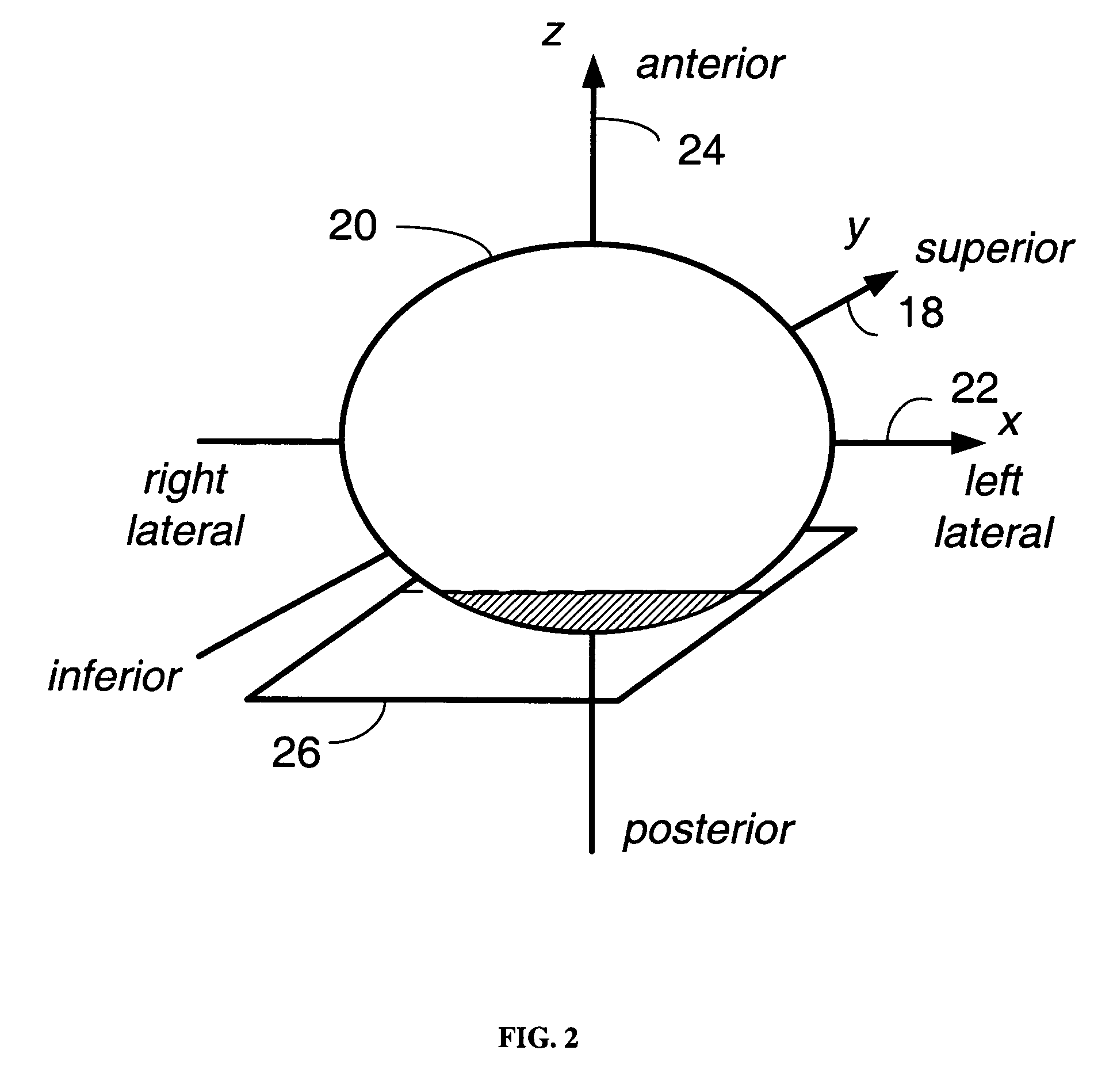 Registration of three dimensional image data with patient in a projection imaging system