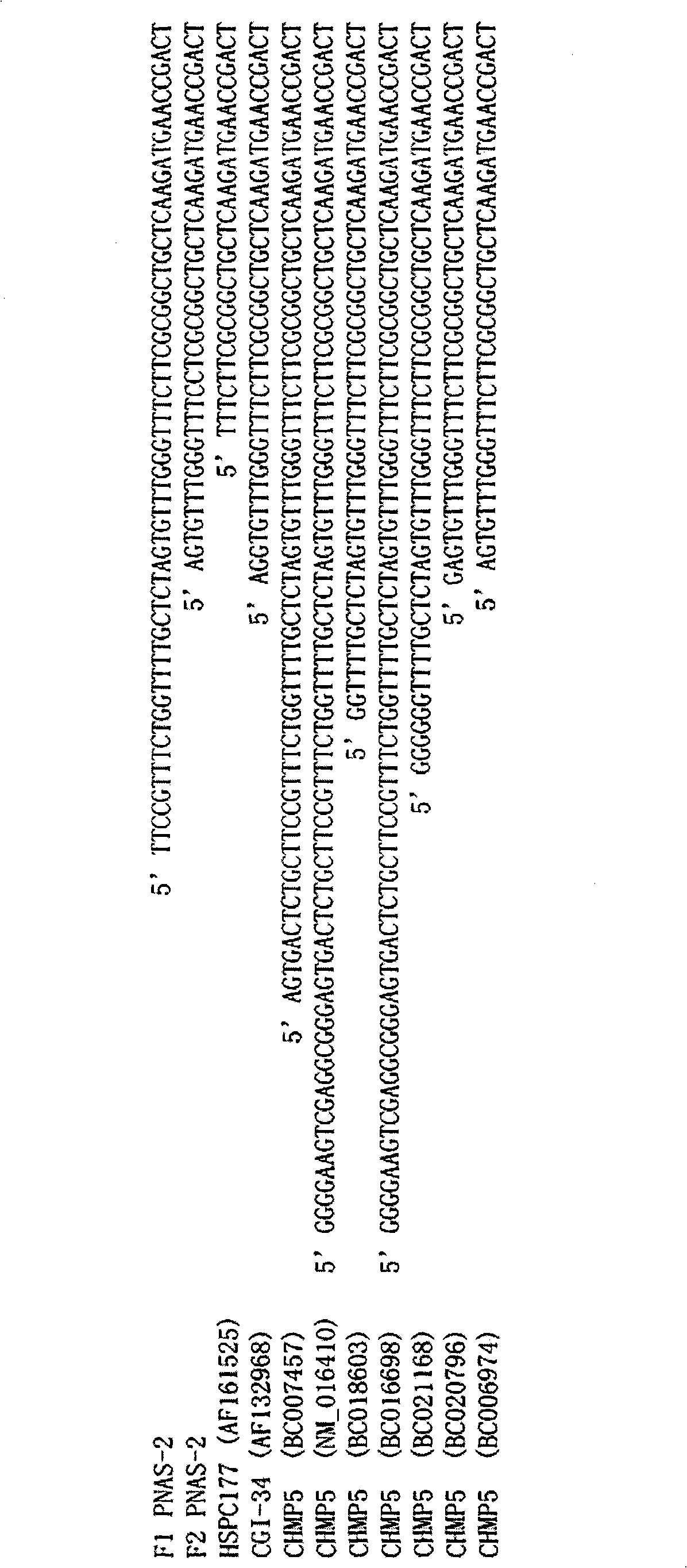 Apoptosis-associated gene and medicaments for treating leucocythemia using the gene as target