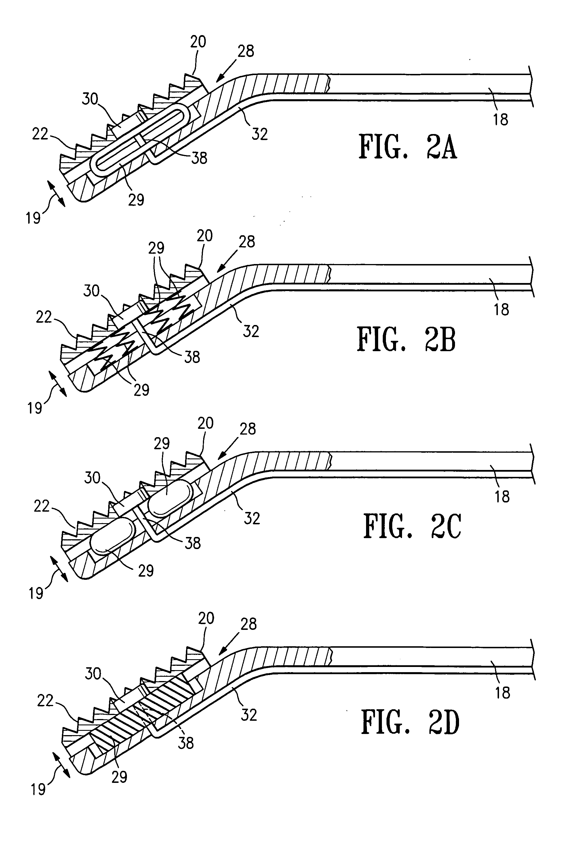 Vascular clamp for caesarian section