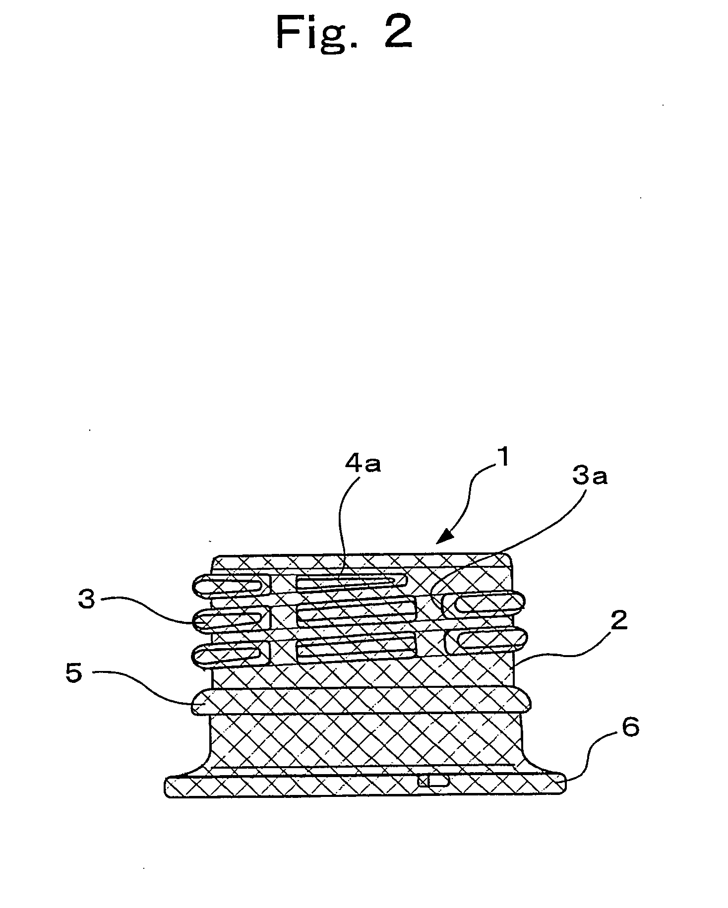 Mouth tube portion of synthetic resin bottle body