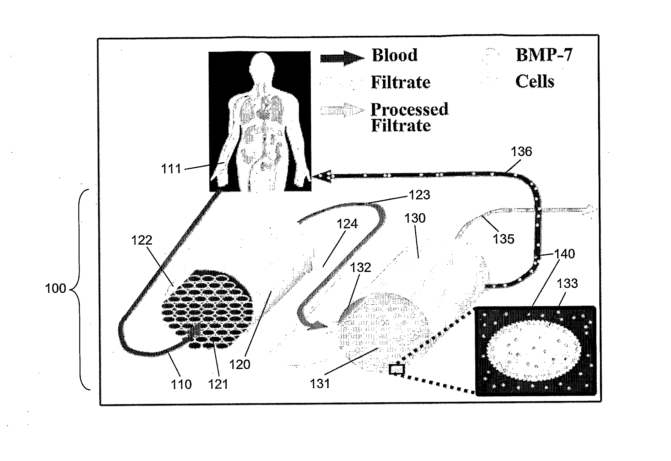 Delivery of bmp-7 and methods of use thereof